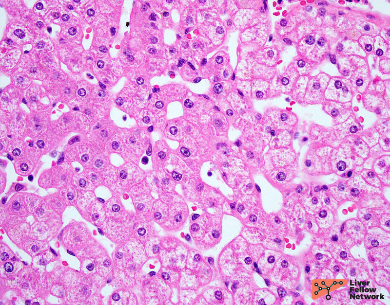Figure-1.-JPEG-Normal-liver_hematoxylin-and-eosin.jpg